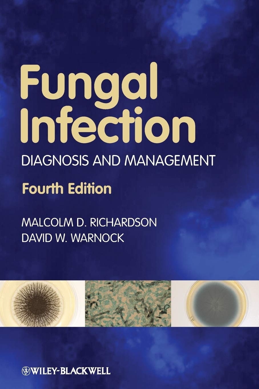Fungal Infection Treatment & Diagnosis Guide | Effective Remedies & Prevention Tips for Athlete's Foot, Ringworm & Yeast Infections | Home & Clinical Care Solutions