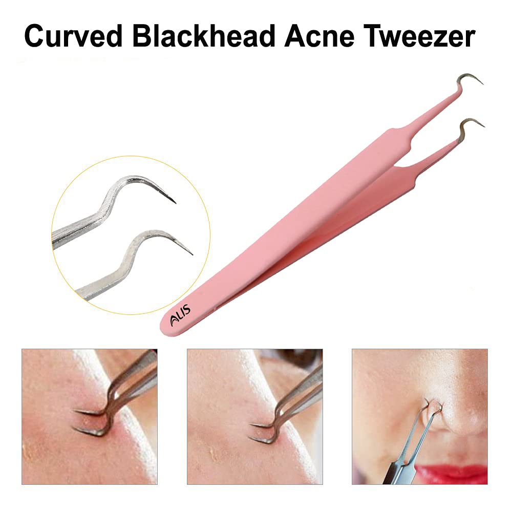 Professional Blackhead Tweezers & Pimple Popper Tool - Curved Bend Head Acne Remover, Facial Cleansing Kit for Blackhead Extraction & Skin Care (3-Piece Pink Set) | Perfect for Home Spa, Acne Treatment & Beauty Routine