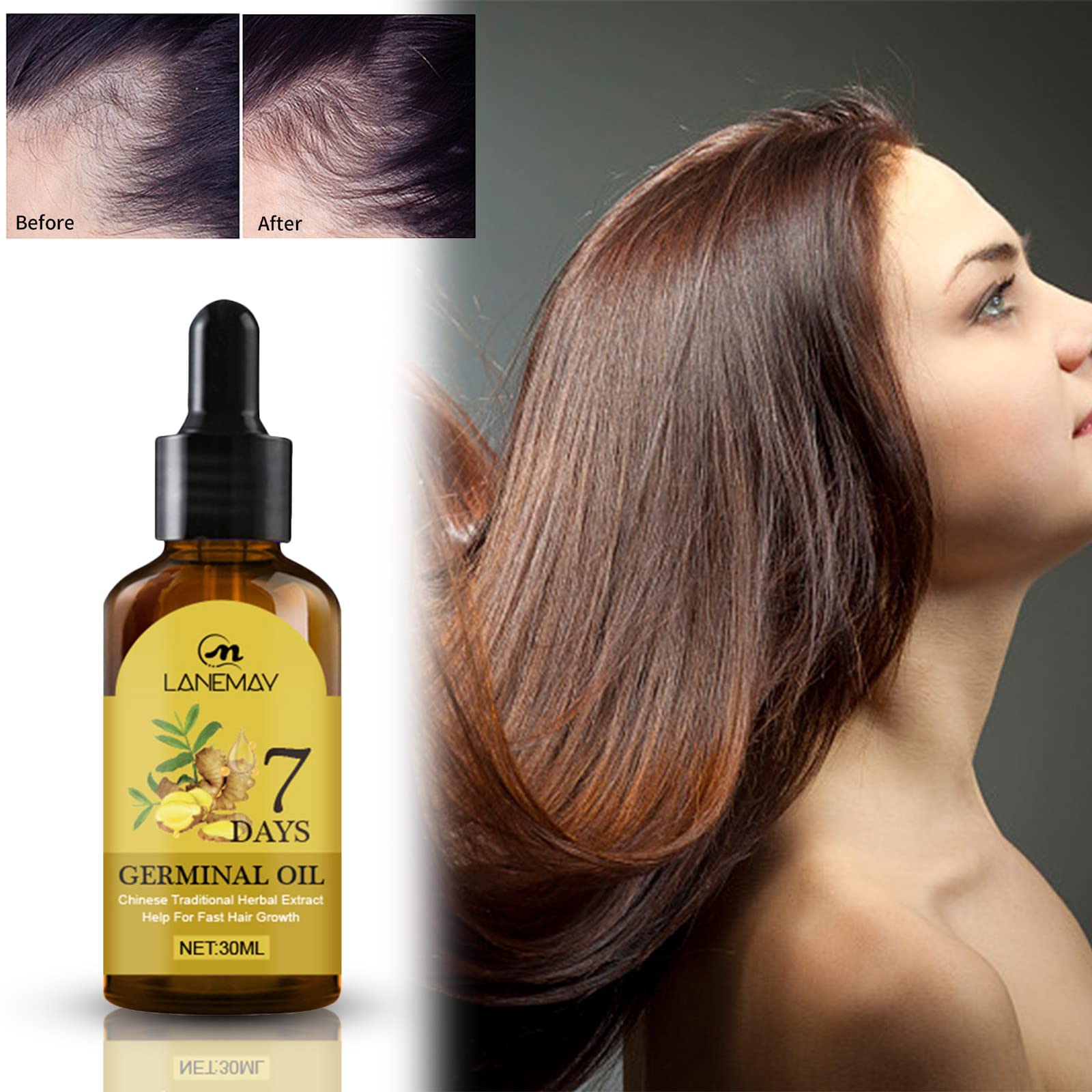 **Ginger Hair Growth Oil for Women & Men - Natural Hair Treatment Serum to Stop Hair Loss, Promote Thicker & Healthier Hair - Ideal for Daily Scalp Care & Thinning Hair Treatment (Yellow)**    **Usage Scenarios:** Perfect for daily hair care routines, promoting thicker hair growth, reducing hair loss, and improving scalp health for both men and women.