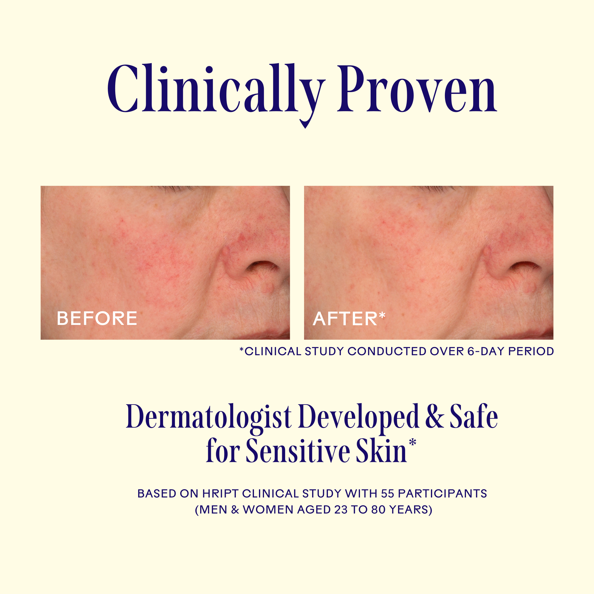 Replenish Ceramides + Blueberry Barrier Repair Serum for Dry Skin – Hydrating Face Serum for Sensitive Skin, Anti-Aging & Night Skincare Routine