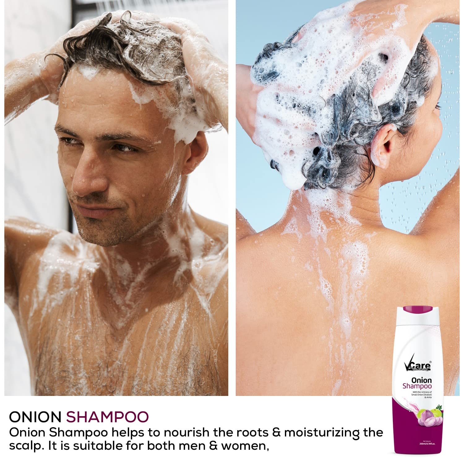 VCare Small Onion Shampoo for Hair Growth & Hair Fall Control - 200ml with Shallot Onion & Amla Extract - Natural Hair Care for Men & Women (Pack of 2) - Promotes Thicker, Stronger Hair for Daily Use & Scalp Health