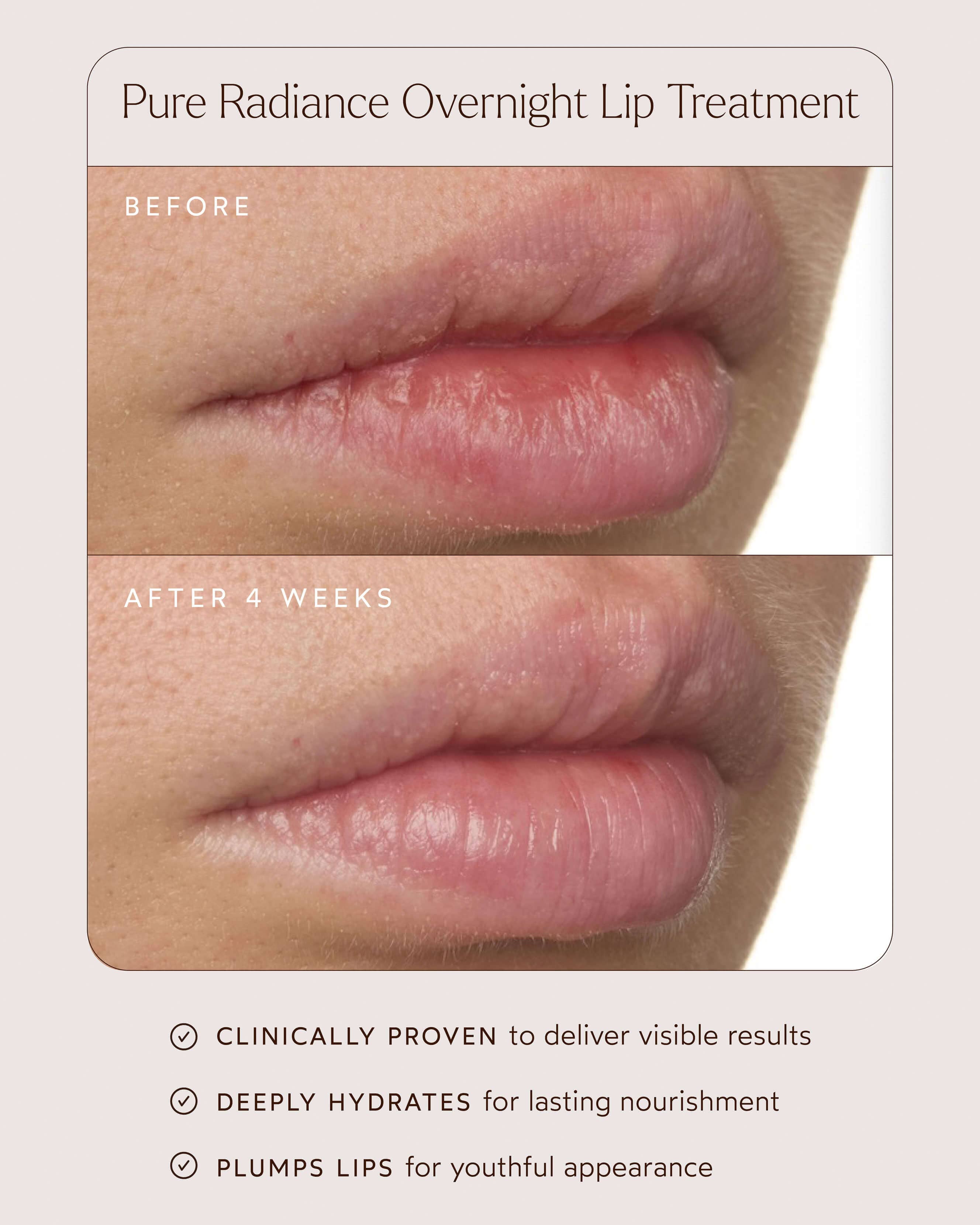 Pure Radiance Overnight Lip Treatment - Hydrating Lip Mask for Dry, Chapped Lips | Best for Nighttime Lip Care & Moisturizing | Perfect for Winter Skincare & Beauty Routine