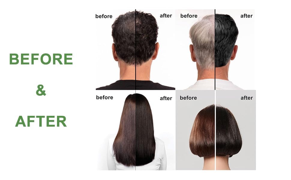 URBANMAC Natural Fruit Vinegar Gel Hair Dye for Black Hair - Ammonia Free, Long Lasting Color (500ml x 2) - Perfect for At-Home Hair Coloring & Gray Coverage