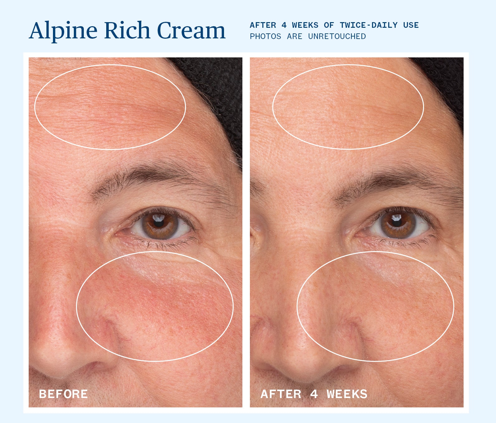Alpine Rich Cream - Premium Moisturizing Face Cream for Dry & Sensitive Skin | Hydrating & Nourishing Skincare for Day & Night Use