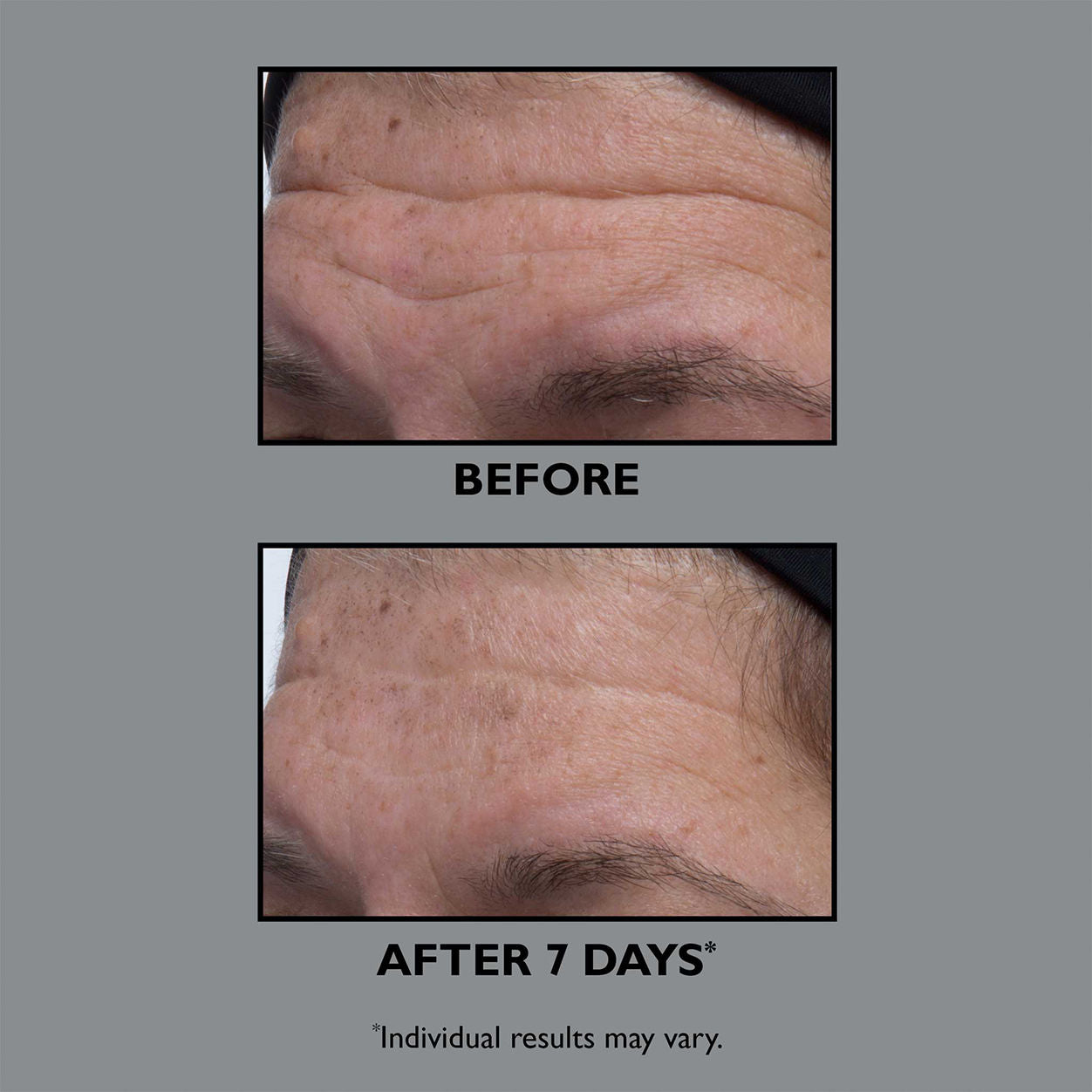 FIRMx Collagen Serum for Face - Anti-Aging & Wrinkle Reduction Treatment - Hydrating & Firming Skincare for Women & Men - Perfect for Night Routine & Daily Moisturizing