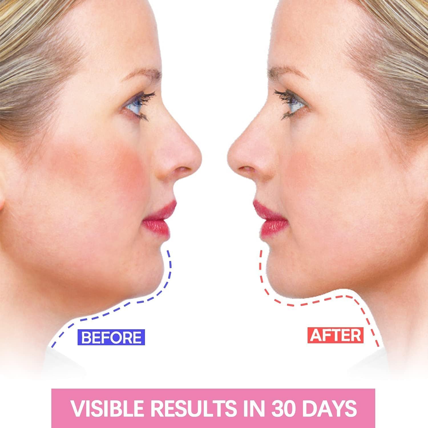 Facial Slimming Strap - Double Chin Reducer & V-Line Lifting Mask for Face Slimming & Chin Up - Reusable Face Lifting Belt for Nasolabial Folds - Perfect for Home Spa, Workout & Beauty Routine