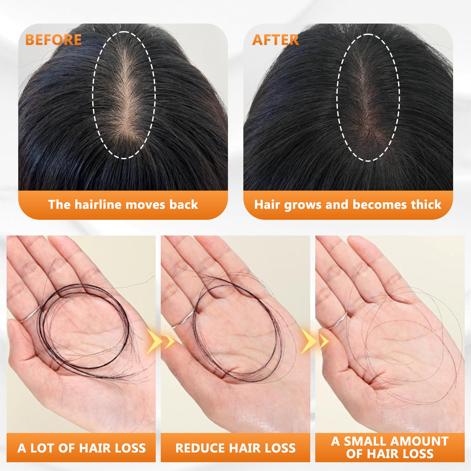 Best Anti Hair Loss Shampoo for Women - Natural Hair Growth Treatment for Thinning Hair & Hair Fall Control - Daily Use Volumizing Shampoo (1 Pack) - Perfect for Postpartum, Stress-Related & Seasonal Hair Loss