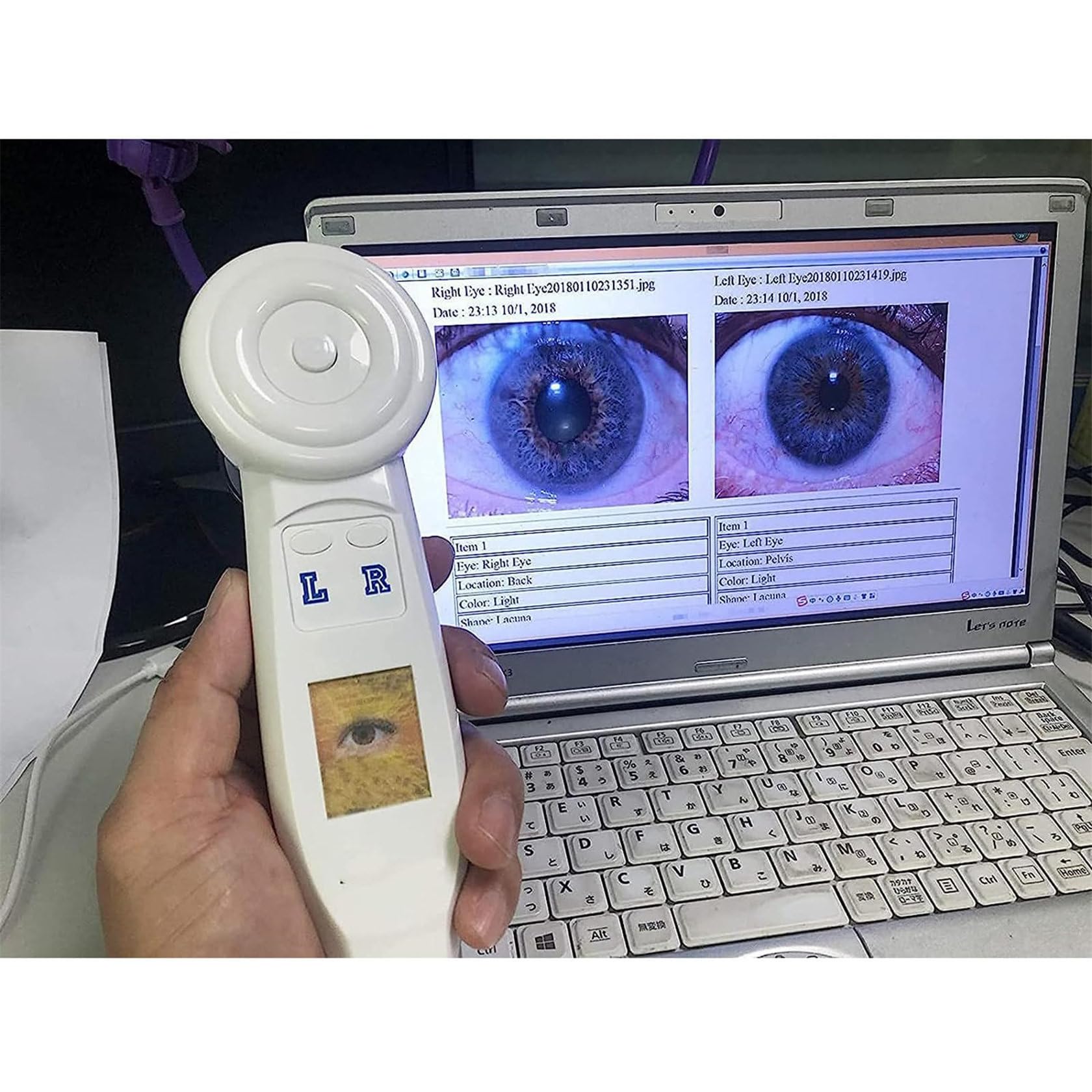 Automatic Iris Detector Camera - Professional Iridology Analysis Tool with Adjustable Focus for Eye Health Diagnosis | Perfect for Naturopaths, Holistic Practitioners & Eye Care Specialists