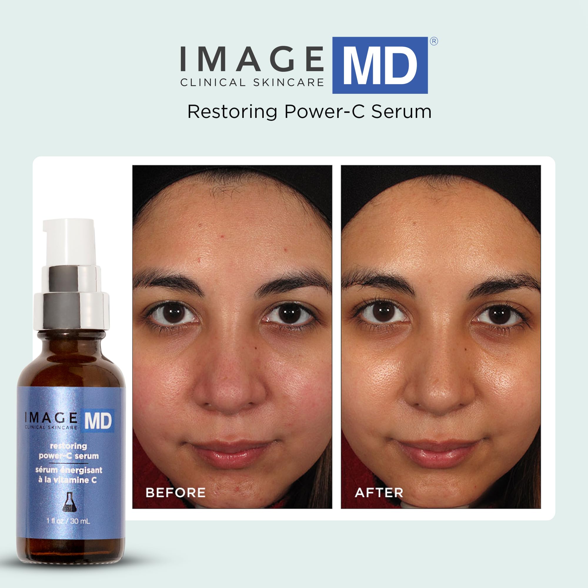 IMAGE MD Restoring Power-C Serum - 20% Vitamin C & Ferulic Acid Facial Treatment for Dark Spots, Wrinkles & Dullness | Anti-Aging Brightening Serum for Firmer, Youthful Glow | Day & Night Skincare Routine