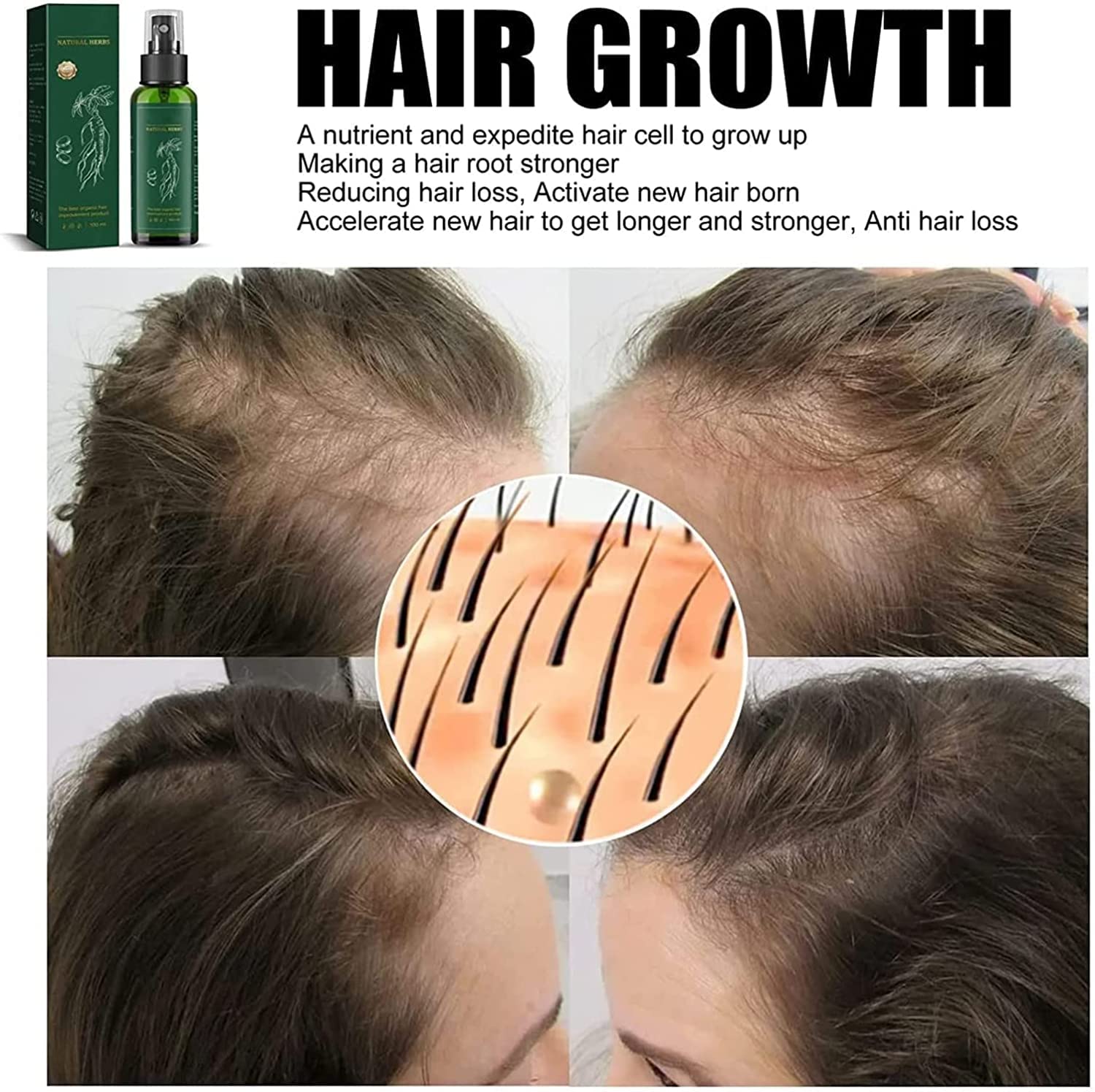 KORTIN Korean Red Ginseng Hair Regrowth Spray - Natural Herbal Hair Growth Serum for Women & Men with Ginger Extract (2 Pack) | Stimulates Hair Follicles & Reduces Hair Loss for Thicker, Healthier Hair