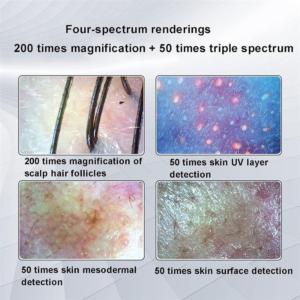 5-200X HD Digital Skin & Hair Detector Analyzer with LCD Screen - Professional Hair Follicle Tester, Scalp & Skin Analysis Tool for Home Salon Use, Beauty Care & Dermatology Examination