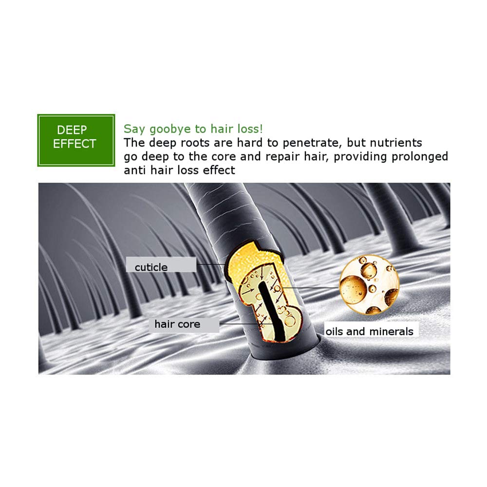 Natural Hair Growth Serum with Ginger Essential Oil - Anti Hair Loss Treatment for Healthy, Strong & Thick Hair | Stimulates Follicles, Reduces Breakage & Revitalizes Scalp | Perfect for Thinning Hair, Baldness & Brittle Hair Care at Home