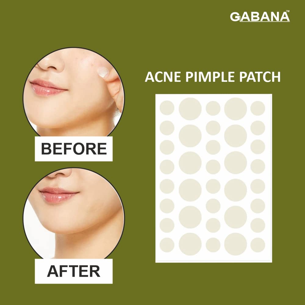 GABANA Acne Pimple Patch for Face - 36 Hydrocolloid Patches for Men & Women | Treats Acne, Dark Spots & Pimple Marks | Suitable for Oily & Dry Skin | Perfect for Overnight Spot Treatment & Daily Skincare Routine