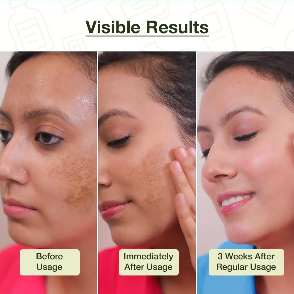 Cos-IQ Complete Skincare Kit for Oily Skin - SPF 50 Sunscreen, ABP 22% Exfoliating Peel, Niacinamide Serum, AirGel Moisturizer & FC-1 Face Wash | Oil Control, Acne Treatment & Daily Sun Protection | Perfect for Combination to Oily Skin Types