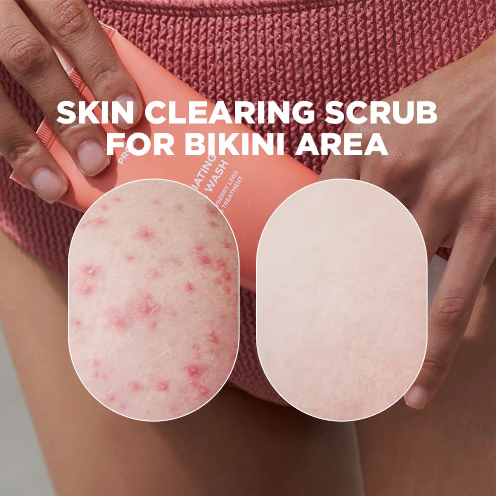 Best Strawberry Legs Treatment Scrub for Women – Exfoliating Body Wash for KP & Chicken Skin – Smooth & Glowing Skin Care – Perfect for Shaving & Post-Waxing Care