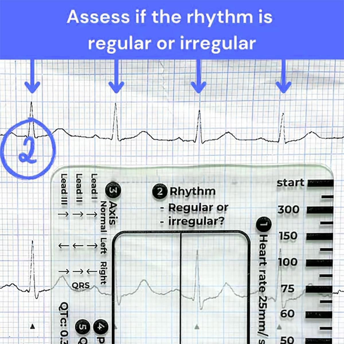 7-Step ECG Ruler for EKG Interpretation - Transparent Plastic Measuring Tool with Calipers, Portable Medical Reference Guide (2-Pack) - Perfect for Nurses, Medical Students & Healthcare Professionals