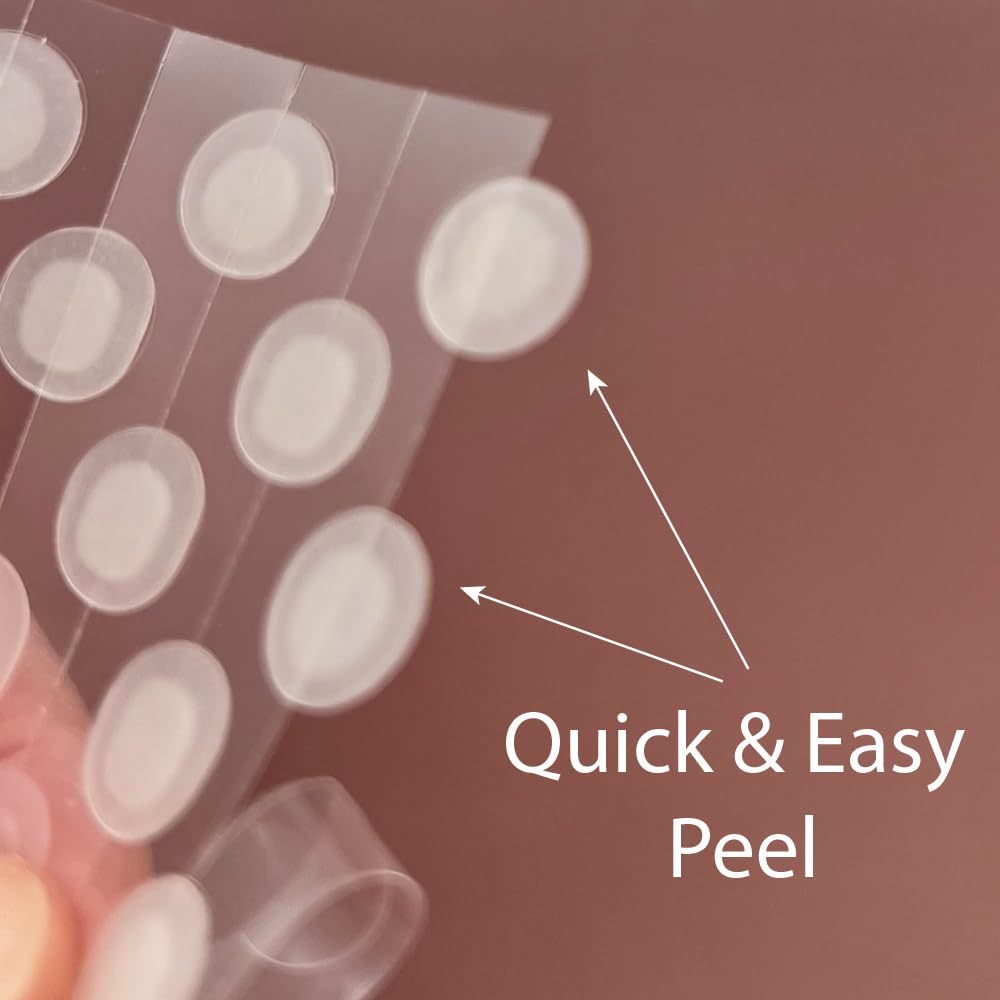 Magic Patch - Hydrocolloid Acne Pimple Patches for Zits & Blemishes | 38 Count Spot Stickers for Face & Skin Care | Korean Beauty (K-Beauty) | Perfect for Overnight Treatment & Daily Acne Relief