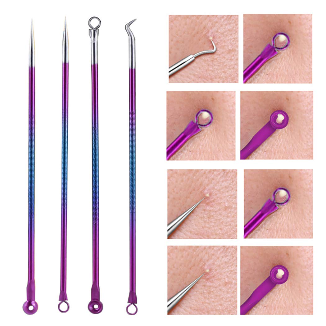 SOWUNO 4PCS Professional Acne Removal Tool Kit - Stainless Steel Blackhead Extractor, Pimple Popper & Comedone Tweezers Set with Travel Case - Perfect for Home Skincare & Travel Use