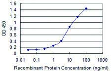 Anti-DPP3 Mouse Monoclonal Antibody [Clone: 3C6] - 100µG for Western Blot, ELISA & Immunohistochemistry - High-Quality Research Antibody for Lab Use