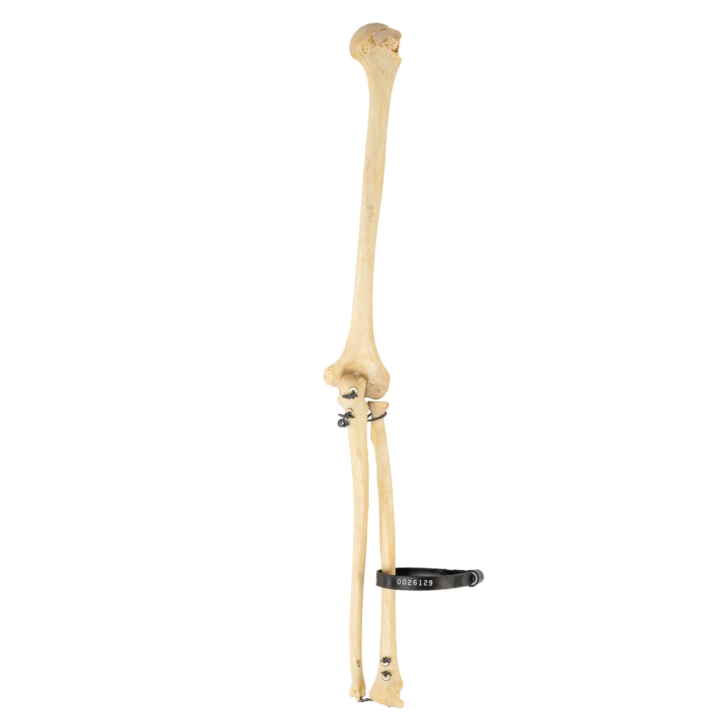 Authentic Human Humerus, Radius & Ulna Bones - Medical Study, Anatomy Education & Science Classroom Demonstration