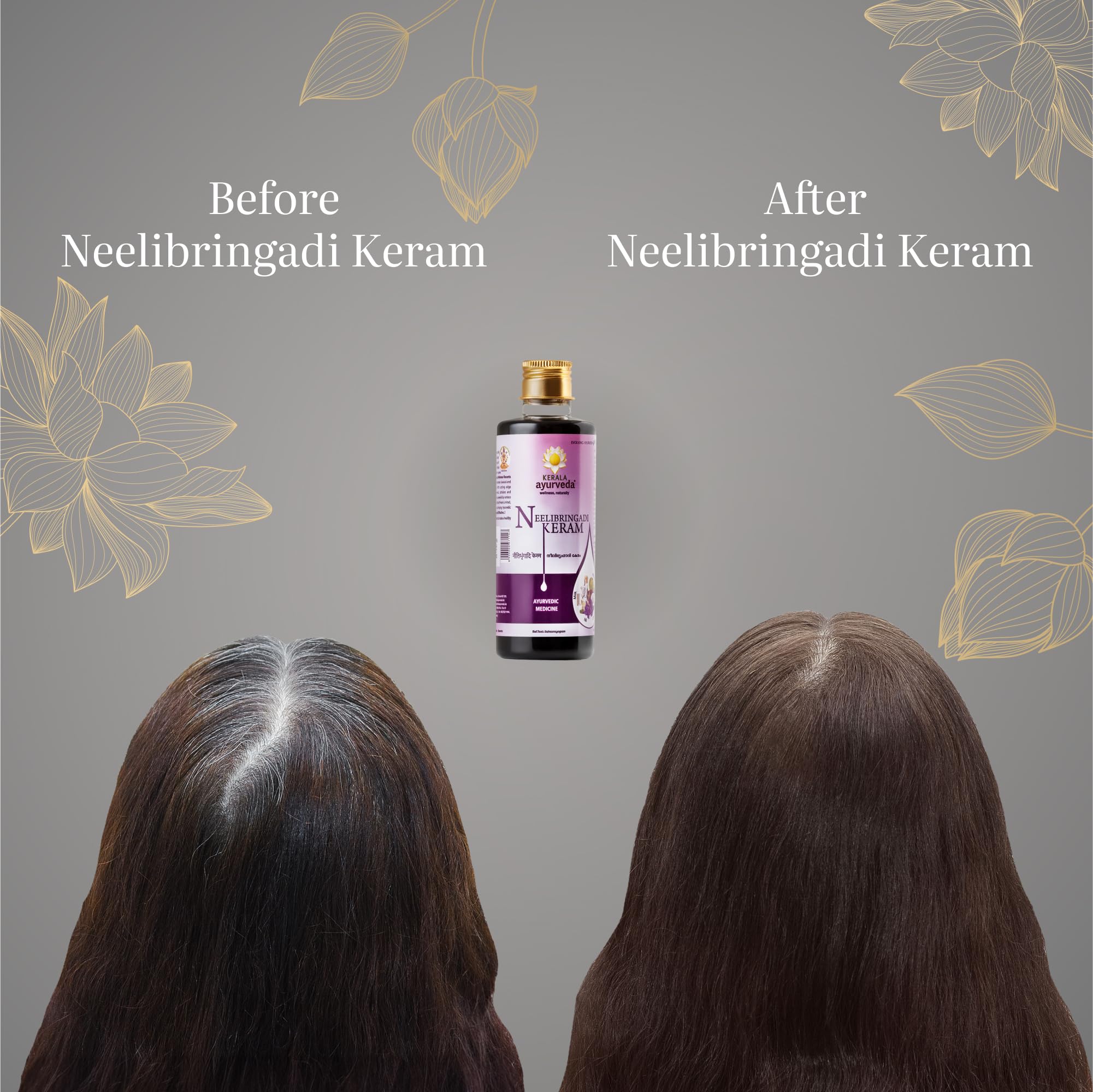 Neelibringadi Keram Ayurvedic Hair Oil - Triple Care Formula for Hair Fall, Dandruff & Growth | Scalp Rebalancing Treatment for Strong, Shiny Hair | Nourishes Hair Follicles | 200ml Bottle | Perfect for Daily Hair Care & Scalp Massage