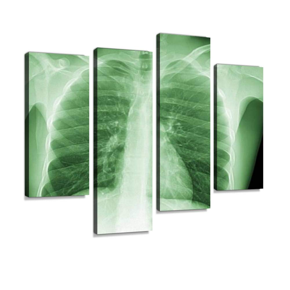 Modern Canvas Wall Art - Framed X-Ray Chest Painting Poster Set of 4 Panels for Living Room Decor | Ready to Hang Home Decoration | Perfect for Bedroom, Office & Gallery Wall Display