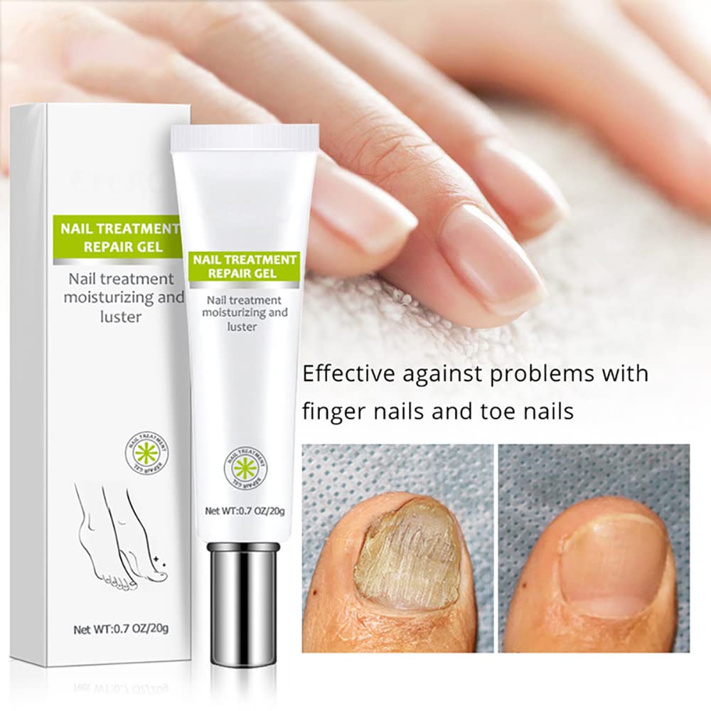 Efero Nail Treatment Repair Gel - Fungal Toenail Treatment, Nail Repair Cream for Yellow, Cracked & Split Nails - Renews Damaged Nails (4PCS) - Perfect for Home Pedicures & Nail Care Routines