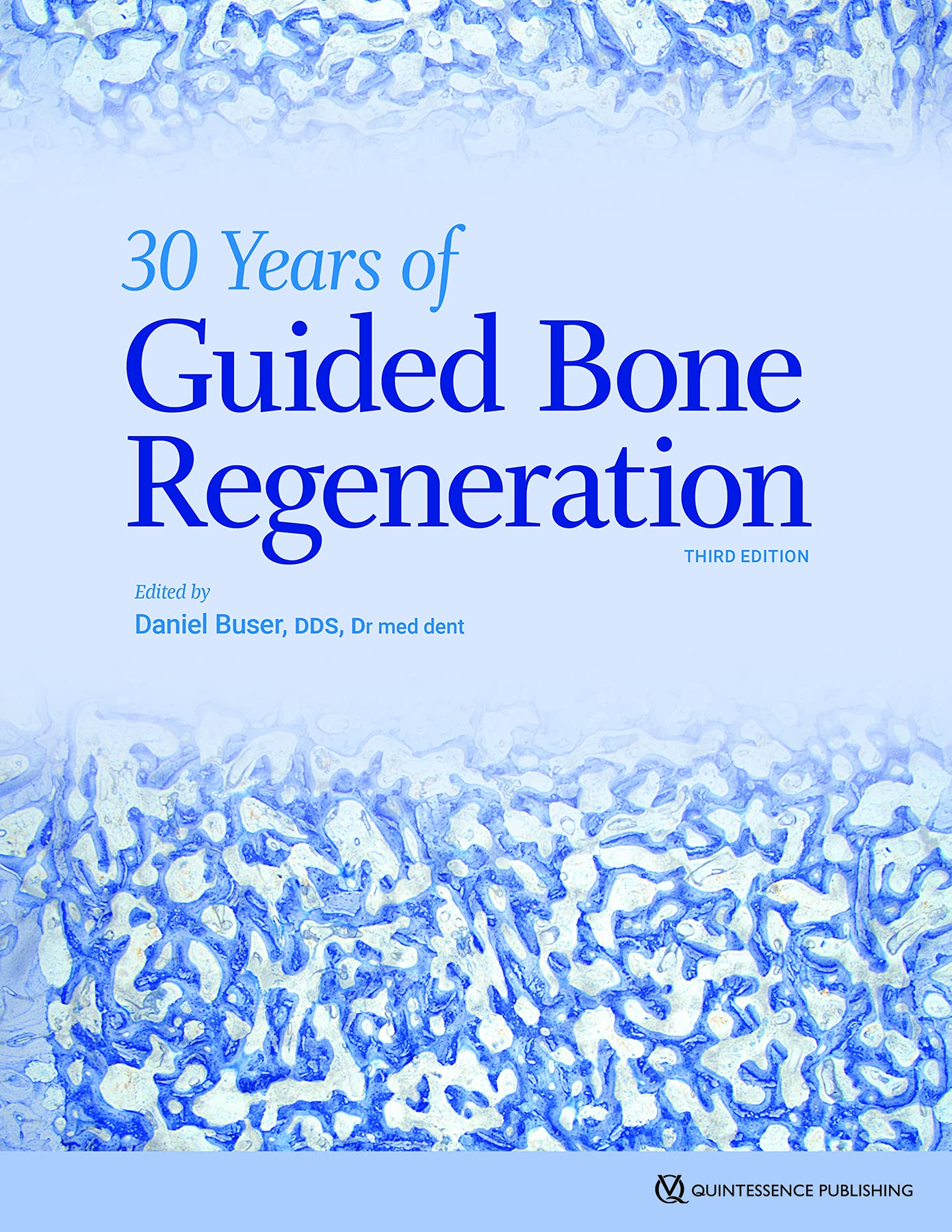 30 Years of Guided Bone Regeneration (GBR) - 3rd Edition Textbook for Dental Implants & Oral Surgery | Essential Guide for Dentists, Periodontists & Dental Students