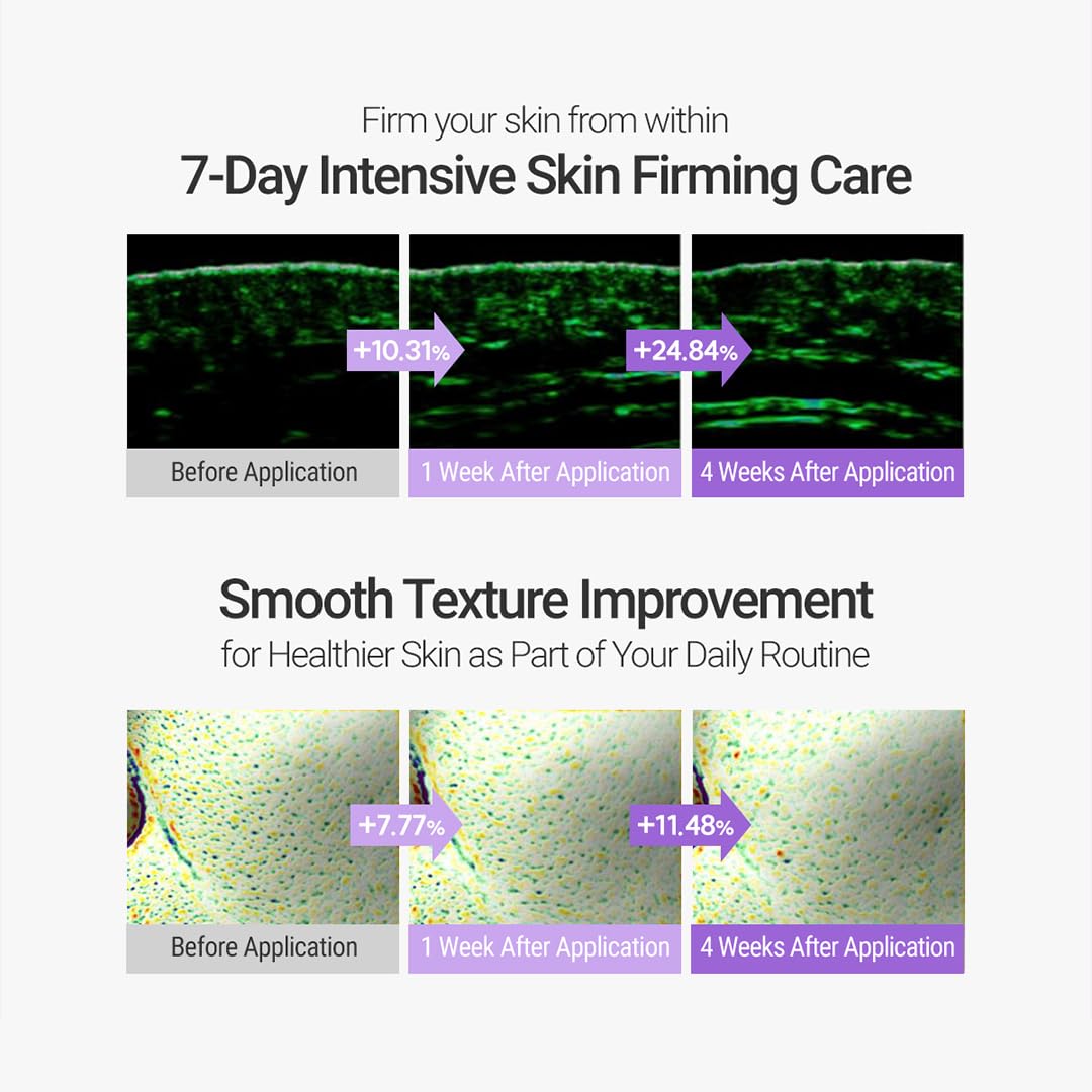 ROVECTIN Retinol Cream 0.15% for Sensitive Skin - Korean Skincare | Night Repair & Anti-Aging