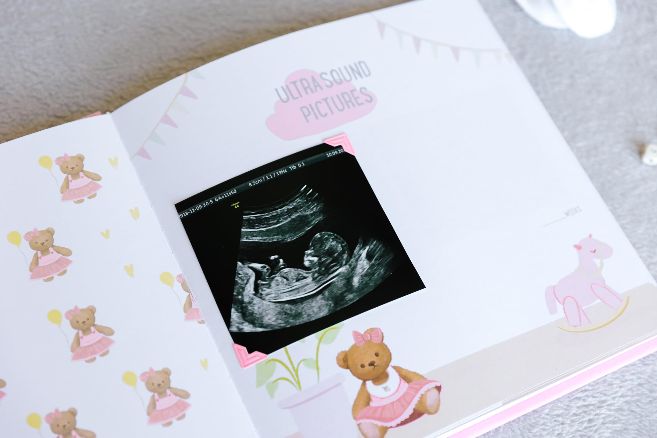 Handmade Baby Memory Book & Photo Album with Keepsake Box - Newborn First Year Scrapbook, Footprint Kit Included - Perfect for Baby Shower Gifts & Milestone Tracking (Teddy Bear Girl, Pink)