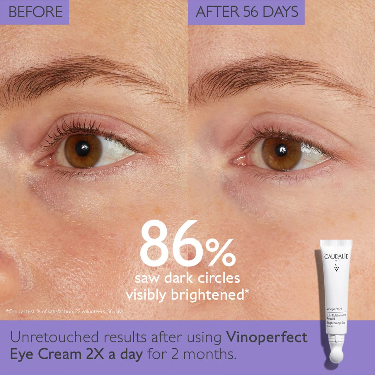 Caudalie Vinoperfect Dark Circle Brightening Eye Cream 15ml - New in Box - Reduce Puffiness & Brighten Under Eyes for Day & Night Use