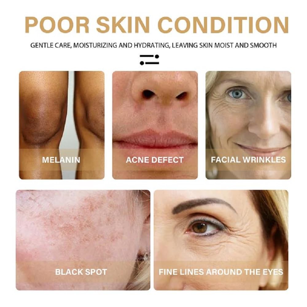 Melanclear Advanced Dark Spot Corrector & Anti-Aging Facial Serum - Collagen Boosting, Moisturizing & Brightening Daily Face Treatment (1PC) - Perfect for Morning/Night Skincare Routine & Hyperpigmentation Care