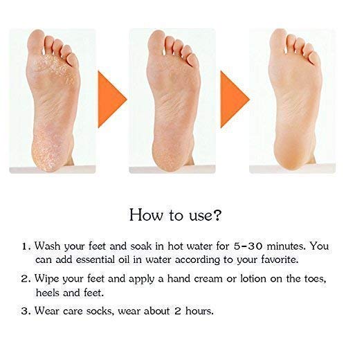 KPS Anti Crack Full Length Silicone Foot Protector Moisturizing Socks for Dry Cracked Feet & Heel Care - Pain Relief Gel Socks for Men & Women - Non-Slip Design - Ideal for Overnight Foot Treatment, Diabetic Foot Care & Post-Pedicure Use (1 Pair)