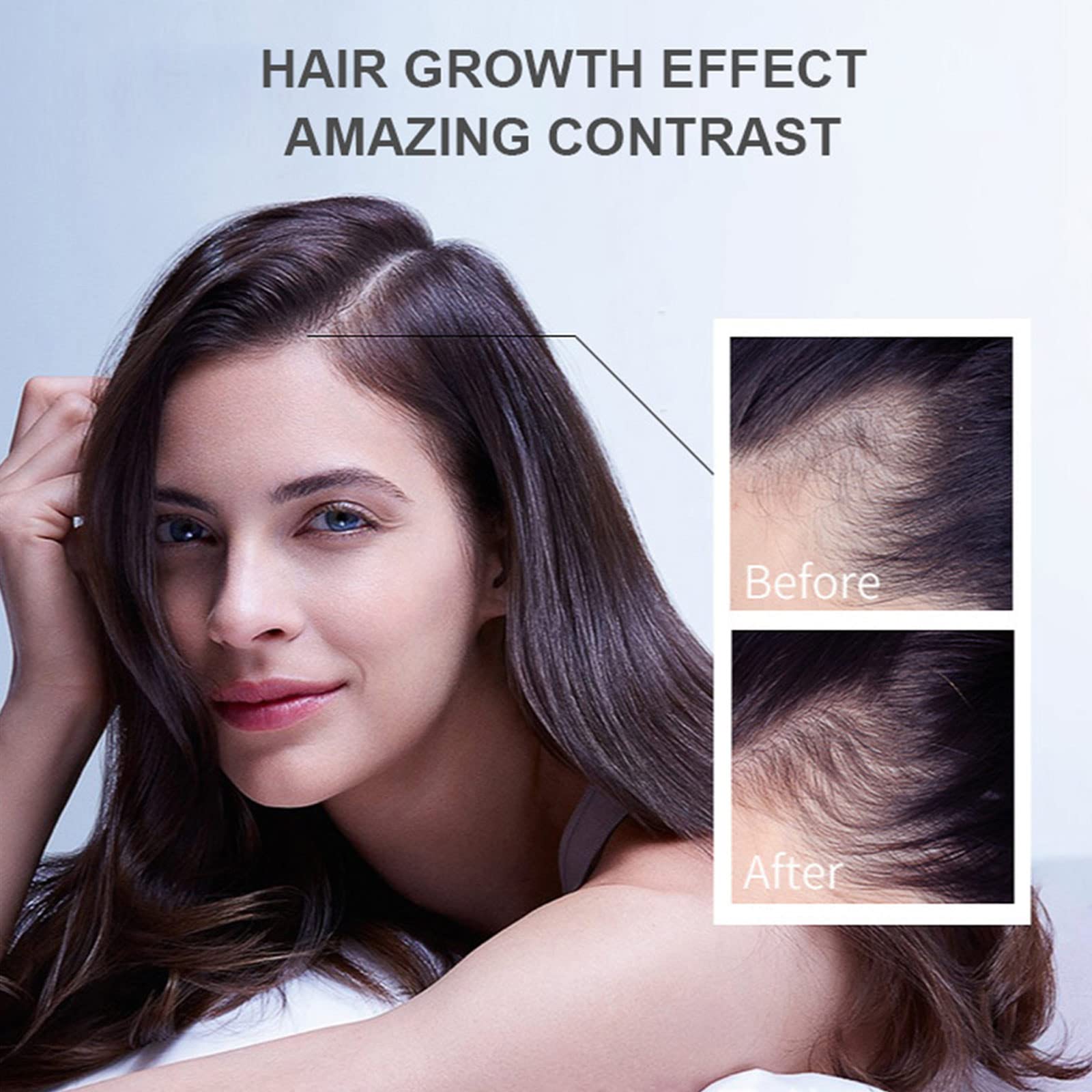 **Ginger Hair Growth Oil for Women & Men - Natural Hair Treatment Serum to Stop Hair Loss, Promote Thicker & Healthier Hair - Ideal for Daily Scalp Care & Thinning Hair Treatment (Yellow)**    **Usage Scenarios:** Perfect for daily hair care routines, promoting thicker hair growth, reducing hair loss, and improving scalp health for both men and women.