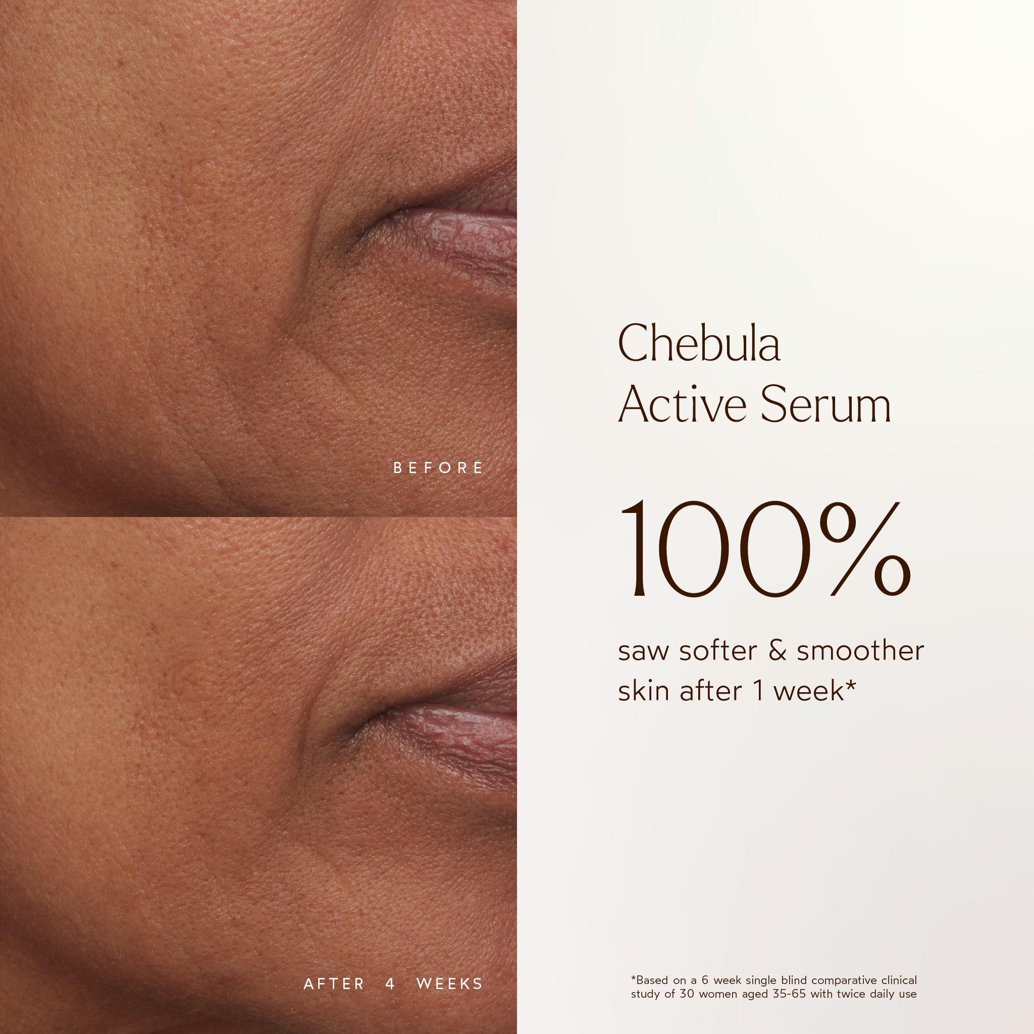 Chebula Active Anti-Aging Serum for Face - Organic Wrinkle Treatment & Skin Tightening Cream - Best for Night Routine, Dry Skin Care & Mature Skin Rejuvenation