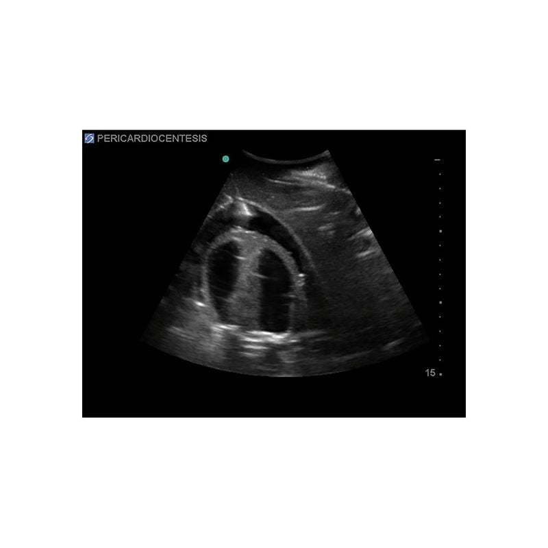 FAST Exam Ultrasound Training Model - Transthoracic & Transesophageal Echo Simulator for Cardiac Sonography Practice (Ideal for Medical Students, Ultrasound Tech Training & Clinical Skills Development)