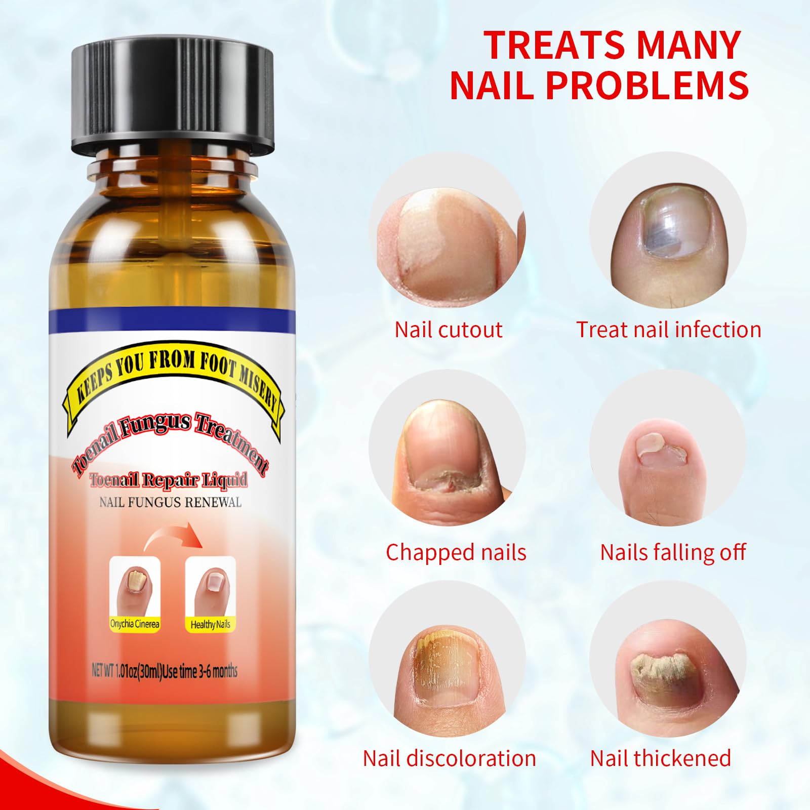 Extra Strength Toenail Fungus Treatment Liquid with Soft Brush Head - Fast & Effective Fungal Nail Solution (30ml) for Healthy Toenails - Perfect for Athletes, Swimmers & Daily Foot Care