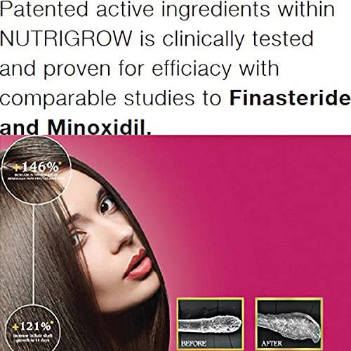 Nutrigrow Anti Hair Loss Shampoo for Faster Hair Growth - Volumizing & Strengthening Formula for Dry & Normal Hair - Perfect for Daily Use & Scalp Care