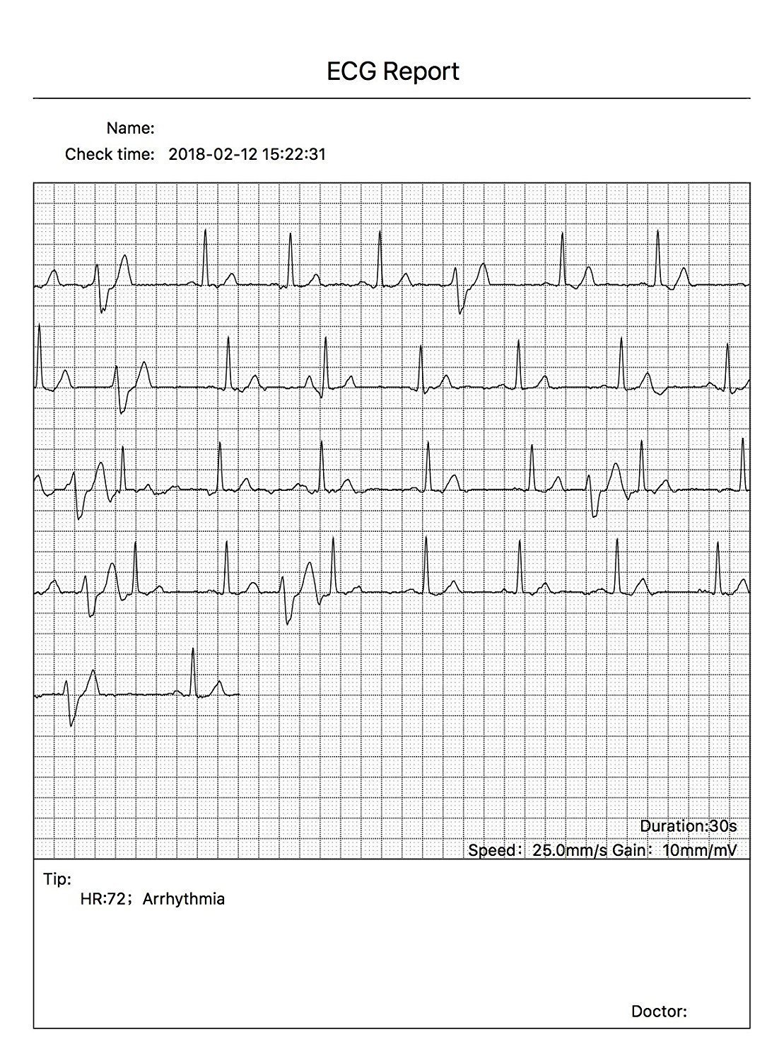 CONTEC Portable ECG/EKG Monitor with PC Software & Bluetooth - Heart Rate Monitor with LCD Display for Home & Clinical Use - Track Heartbeat & Electrocardiogram Data Anytime, Anywhere