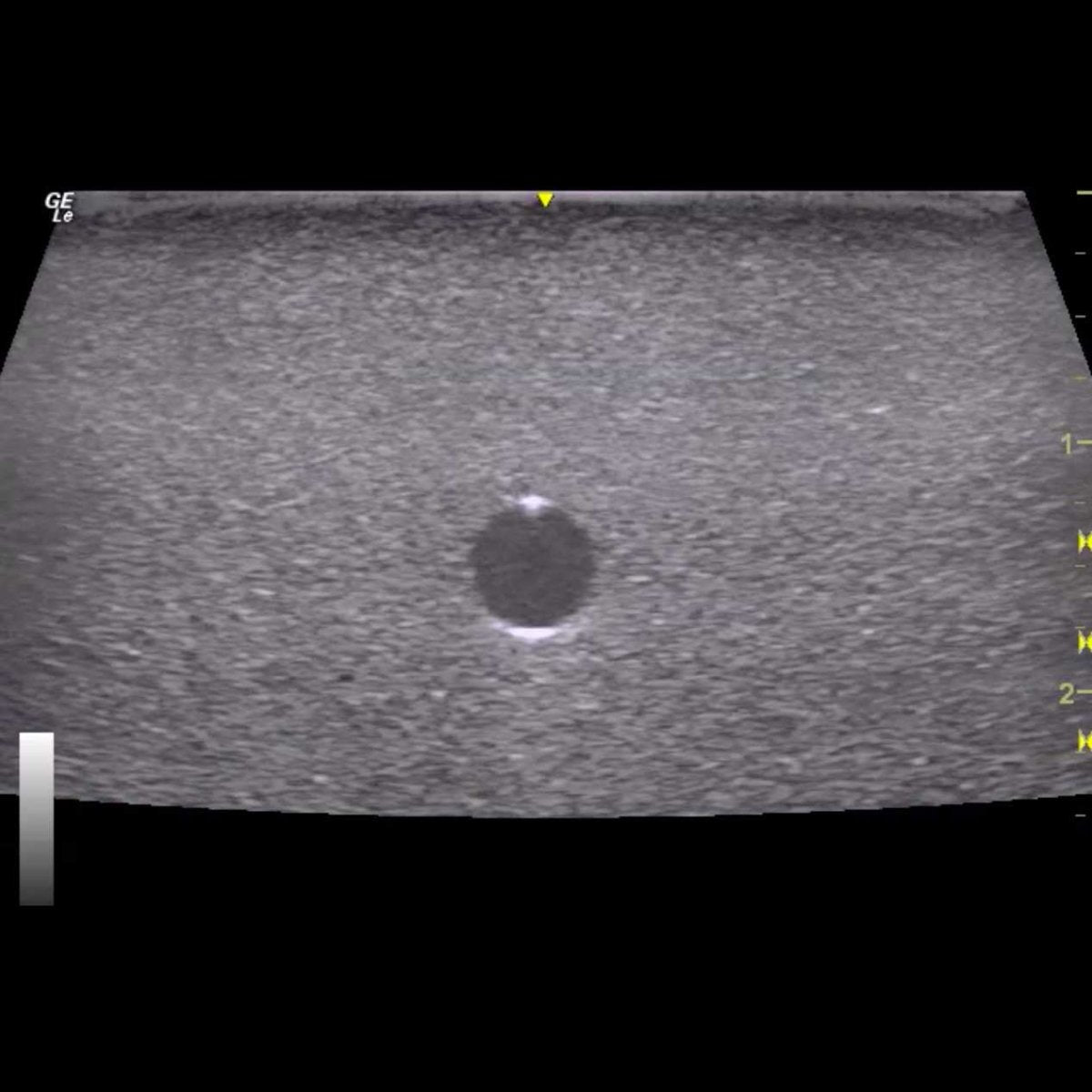 HM4.0 Reusable 4-Vessel Ultrasound Training Model - Perfect for Medical Students, Sonographers & Vascular Practice (Ideal for Carotid, Femoral & Venous Ultrasound Training)