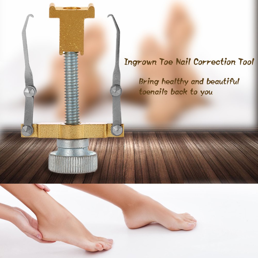 Ingrown Toenail Corrector Tool - Professional Toenail Treatment & Pedicure Kit for Pain Relief & Nail Care - Perfect for Home Use & Salon Treatments