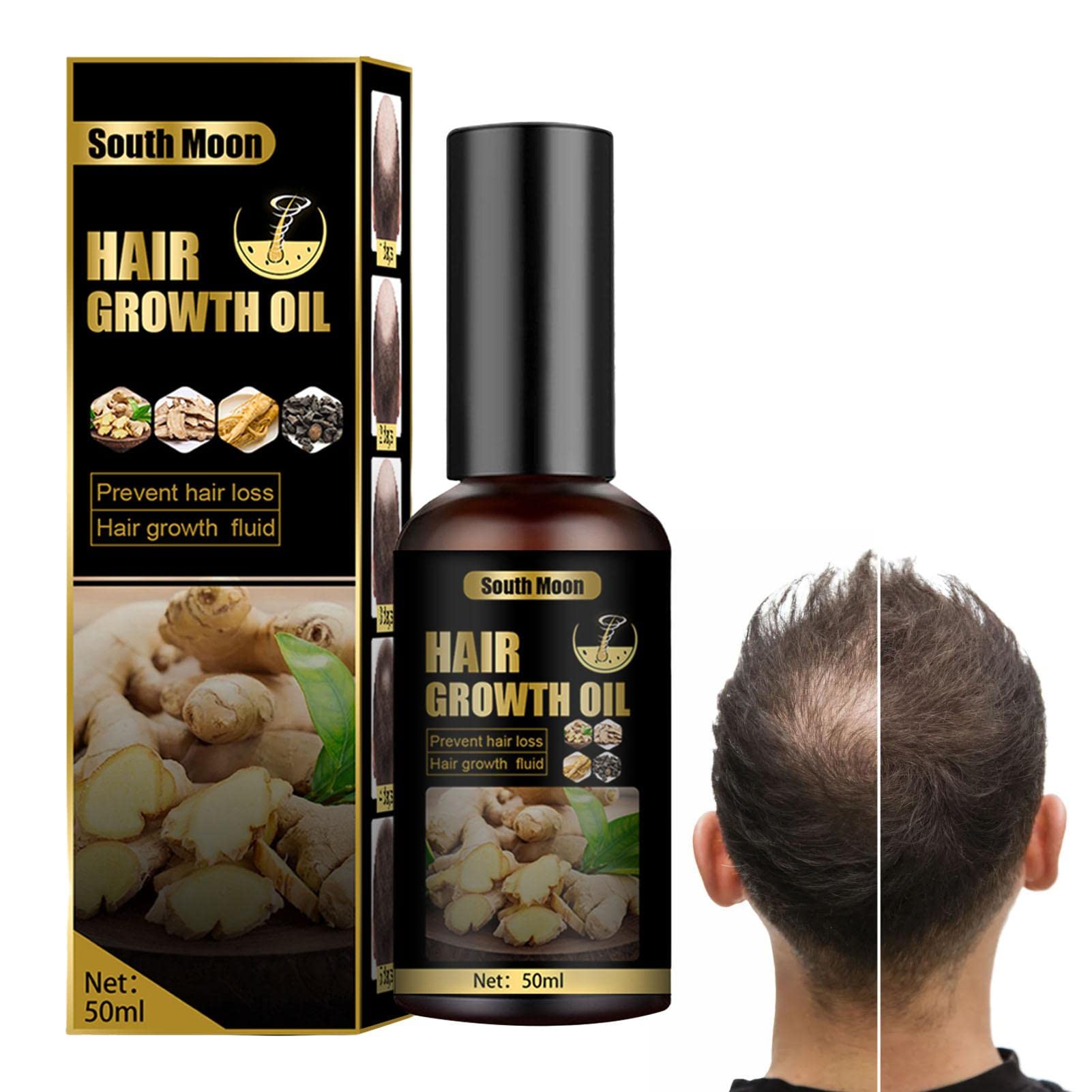 AUTOECHO Anti-Hair Loss Treatment - Ginger Germinal Essential Oil for Hair Regrowth | Natural Hair Thickening & Strengthening Solution for Thicker, Longer, Fuller & Healthier Hair | Perfect for Daily Scalp Care & Hair Growth Routine