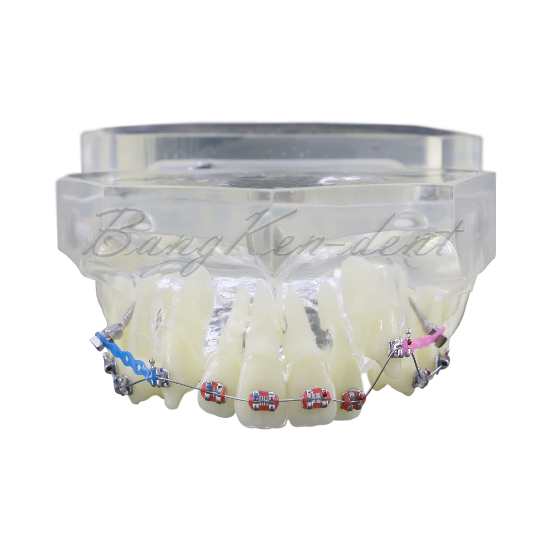 Orthodontic Typodont Dental Model with Braces, Arch Wire, Bracket & Buccal Tube - Premolar Deformity Teaching Demonstration Kit for Dental Students & Professionals (M3005-CLEAR) - Perfect for Dental School Practice, Orthodontic Training & Clinical Demonstrations