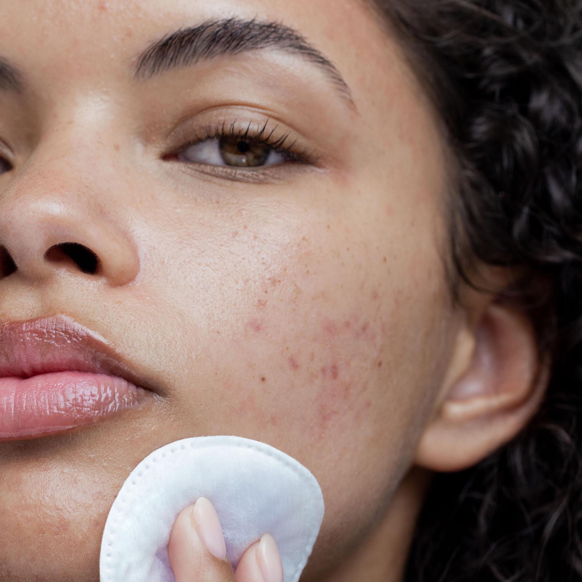 Clenziderm M.D. Pore Therapy - Dermatologist-Recommended Acne Treatment for Clear Skin | Perfect for Daily Skincare Routine & Blemish Control