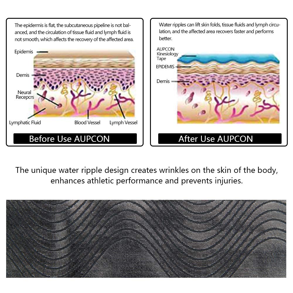 AUPCON Kinesiology Tape - Elastic Therapeutic Sports Tape for Muscle Support & Recovery | Hypoallergenic, Breathable Cotton | Ideal for Knee, Shoulder, Ankle, Elbow & Shin Pain Relief | Perfect for Athletes, Physical Therapy & Post-Workout Recovery