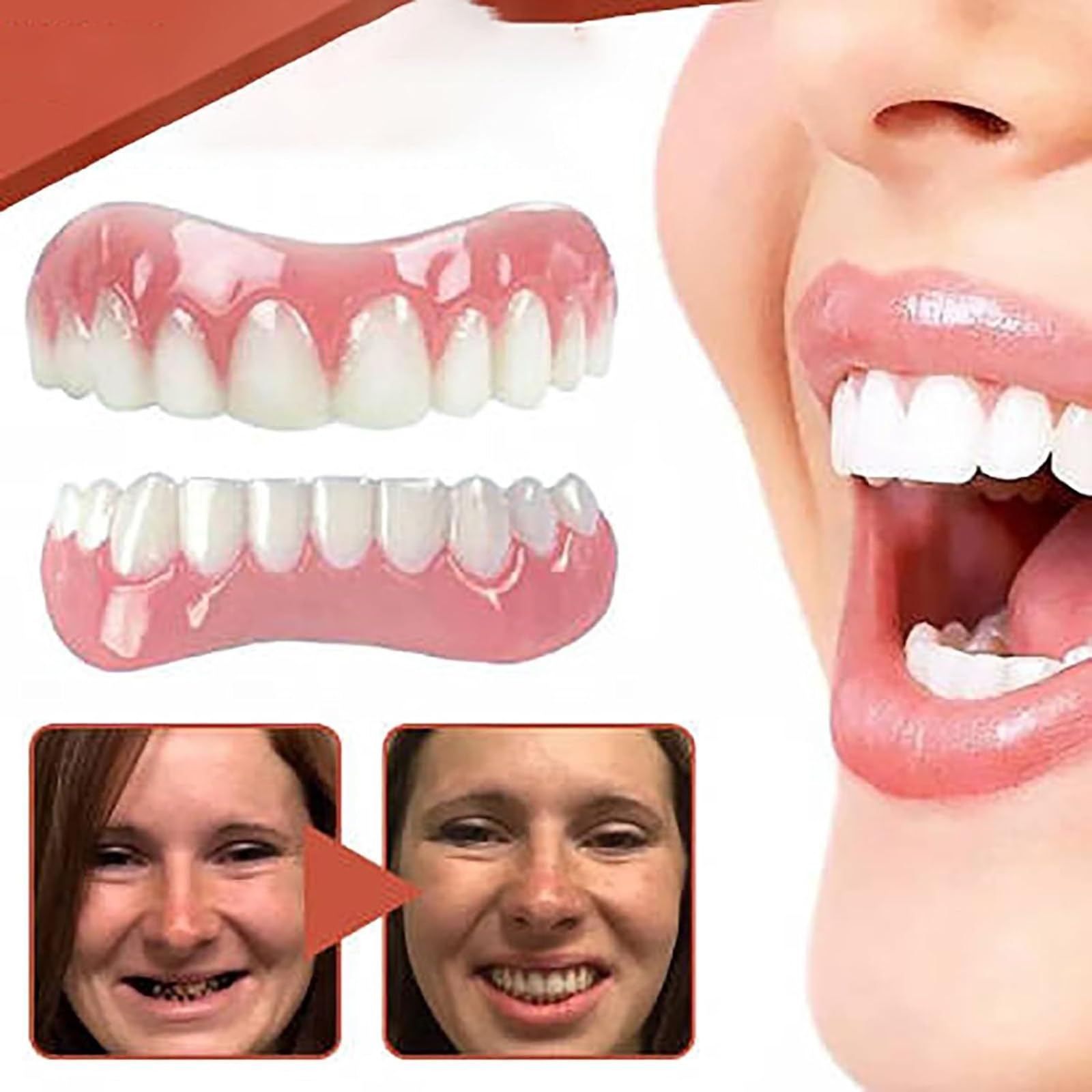 Premium Denture Reline Kit - Soft Silicone Denture Reliner for Comfortable Fit - Easy-to-Use Dental Relining Material for Men & Women - Perfect for Denture Adjustment & Pain Relief (1 Pack) - Ideal for Home Dental Care & Denture Maintenance