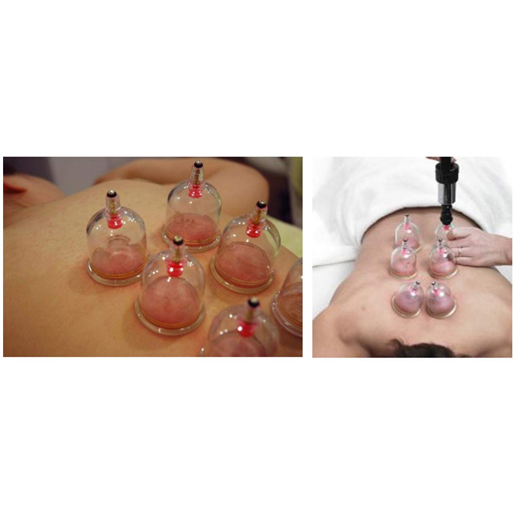 Korean Daegun Plastic Air Vacuum Suction Massage Cup Set - 15 Pieces with Hand Pump for Body Pain Relief, Cellulite Treatment & Muscle Relaxation - Perfect for Home Spa, Physical Therapy & Self-Care Routine