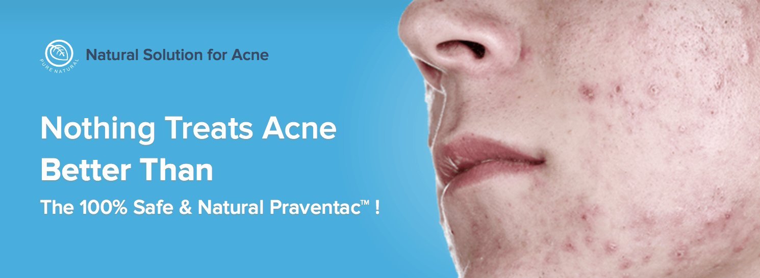 Natural Acne Treatment Supplement - Reduce Pimples, Blemishes & Scars for Clear Skin | Face & Body Acne Relief | 60 Capsules | Safe & Effective for Oily Skin | Perfect for Daily Skincare Routine & Travel