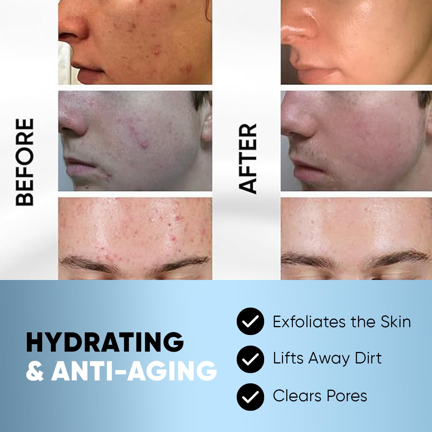 ESTETIST Salicylic & Glycolic Acid Exfoliating Face Pads - Hydrating Acne Treatment with Natural Extracts | Gentle Cleansing Pads for Men & Women | 60 Count | Perfect for Daily Skincare Routine & Travel