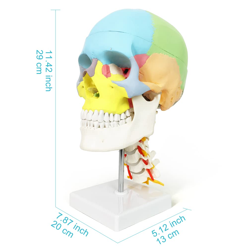Human Anatomy Exploded Skull Model - Medical & Dental Teaching Tool for Students | Perfect for Classroom Demonstrations, Dental Clinics & Medical Education